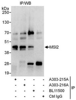 Detection of human MSI2 by western blot of immunoprecipitates.