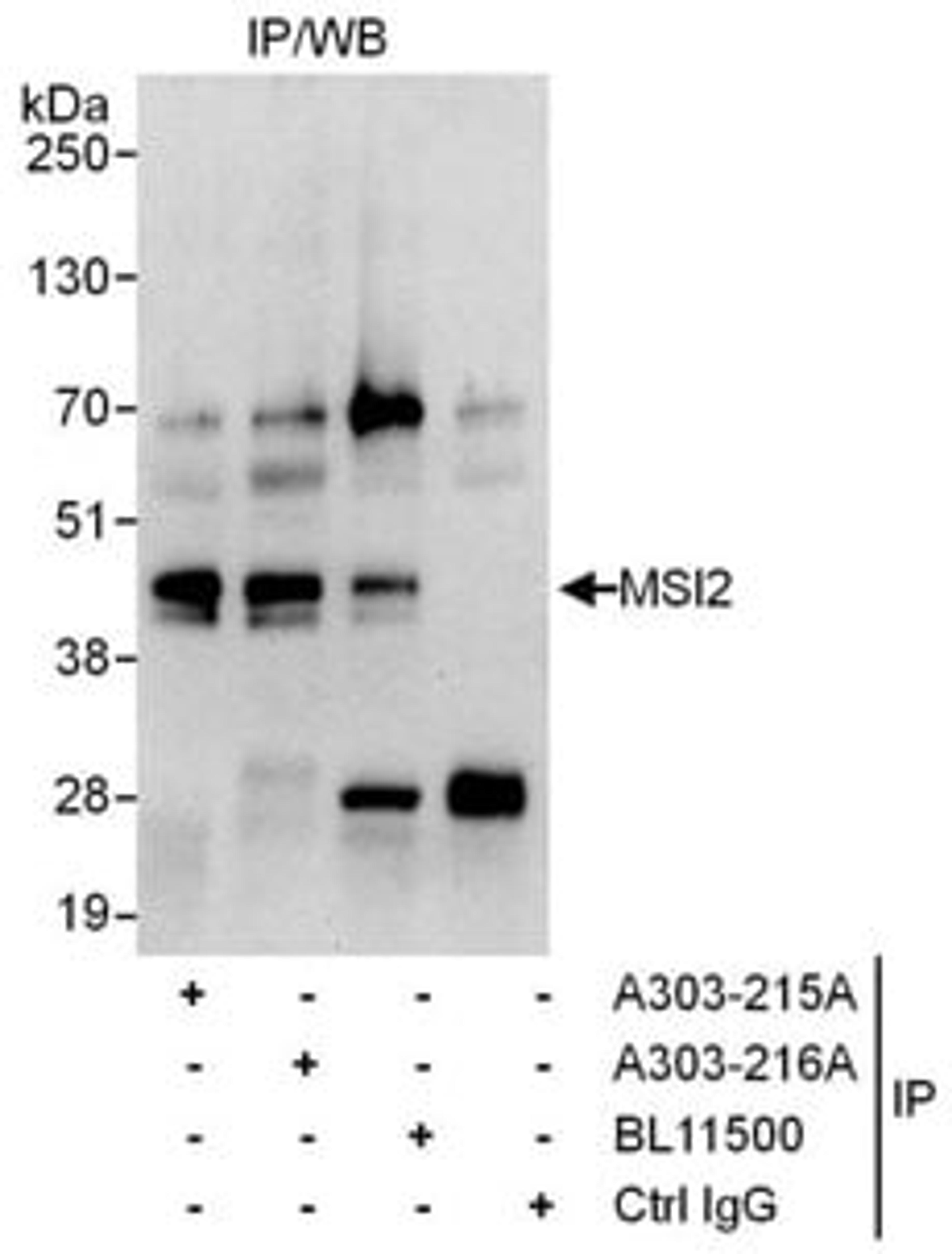 Detection of human MSI2 by western blot of immunoprecipitates.