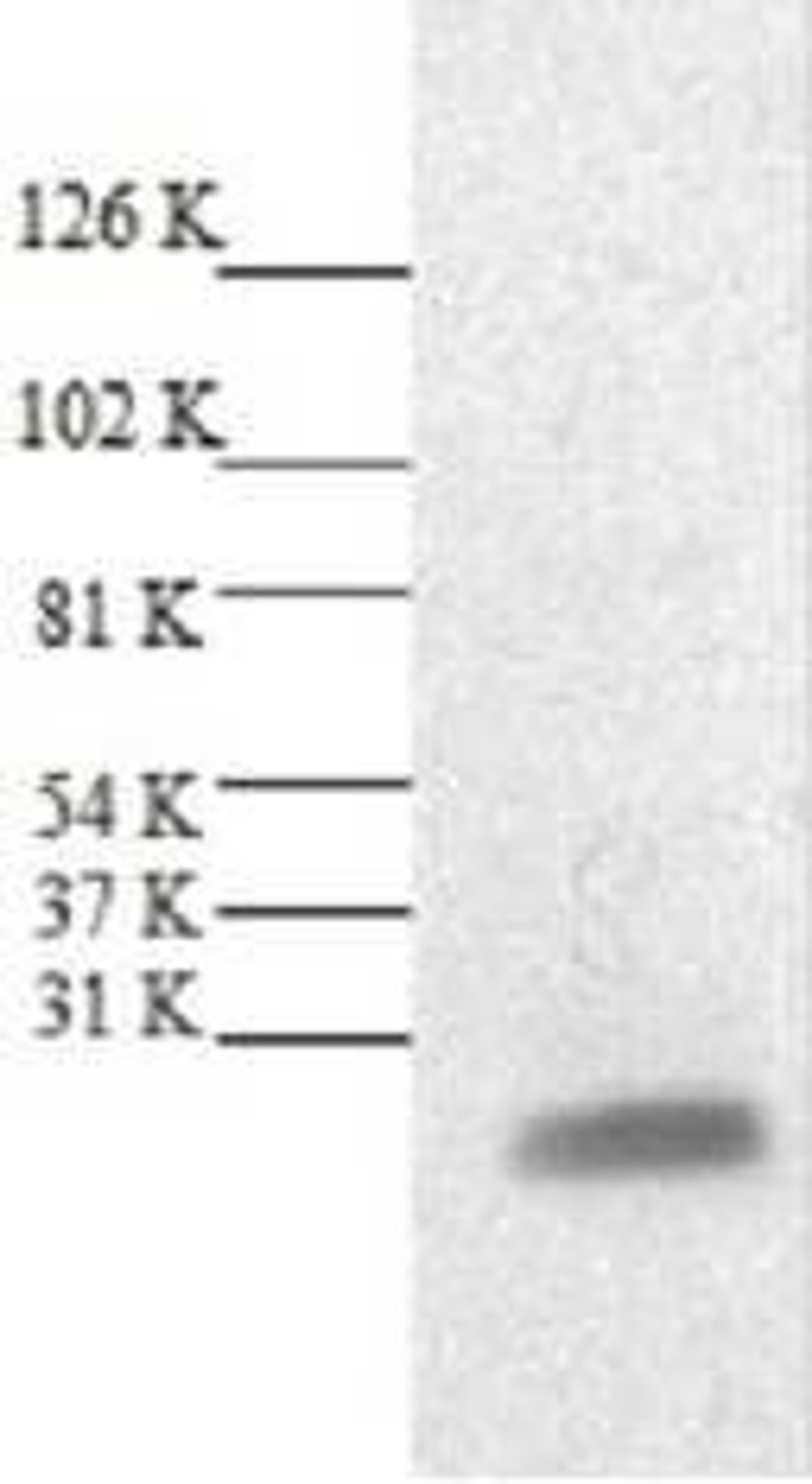 Western blotting analysis of HeLa whole cell lysate probed with Rabbit anti BAX antibody