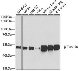 Western blot - ß-Tubulin antibody (AC021)