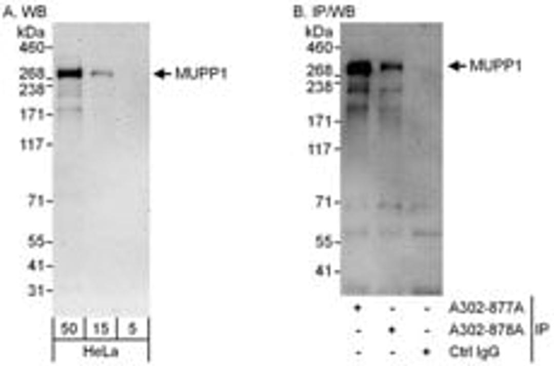 Detection of human MUPP1 by western blot and immunoprecipitation.