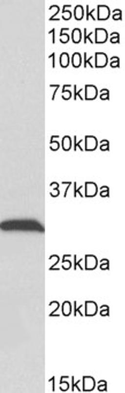 43-555 (0.1ug/ml) staining of Rat Skeletal Muscle lysate (35ug protein in RIPA buffer). Primary incubation was 1 hour. Detected by chemiluminescence.