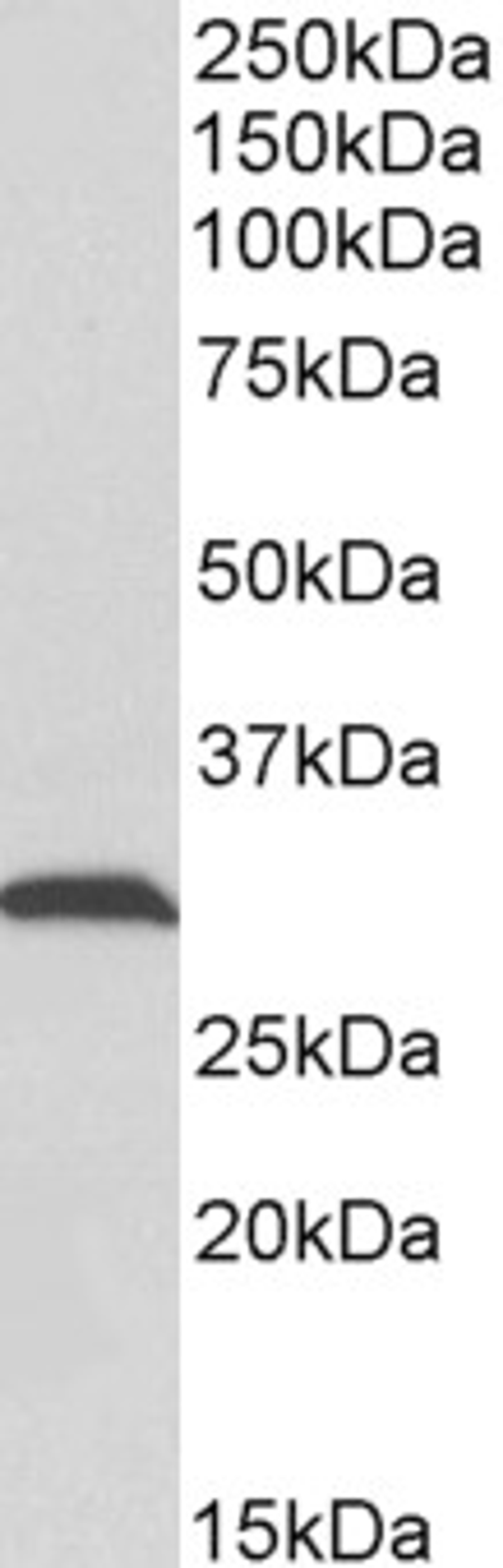 43-555 (0.1ug/ml) staining of Rat Skeletal Muscle lysate (35ug protein in RIPA buffer). Primary incubation was 1 hour. Detected by chemiluminescence.