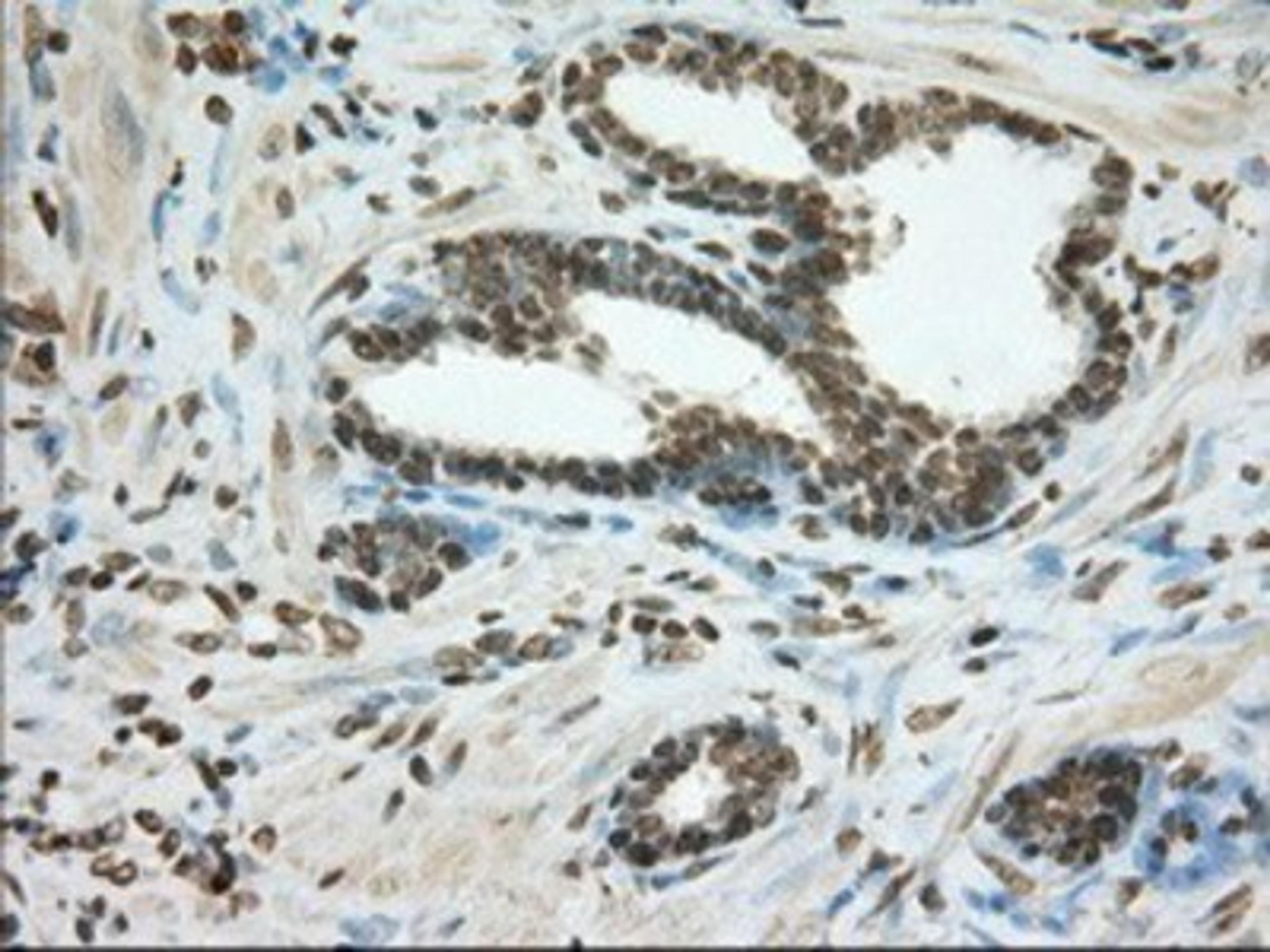 Immunohistochemistry-Paraffin: Cytochrome P450 1A2 Antibody (8F1) [NBP2-02563] - Staining of paraffin-embedded Carcinoma of Human prostate tissue using anti-Cytochrome P450 1A2 mouse monoclonal antibody.