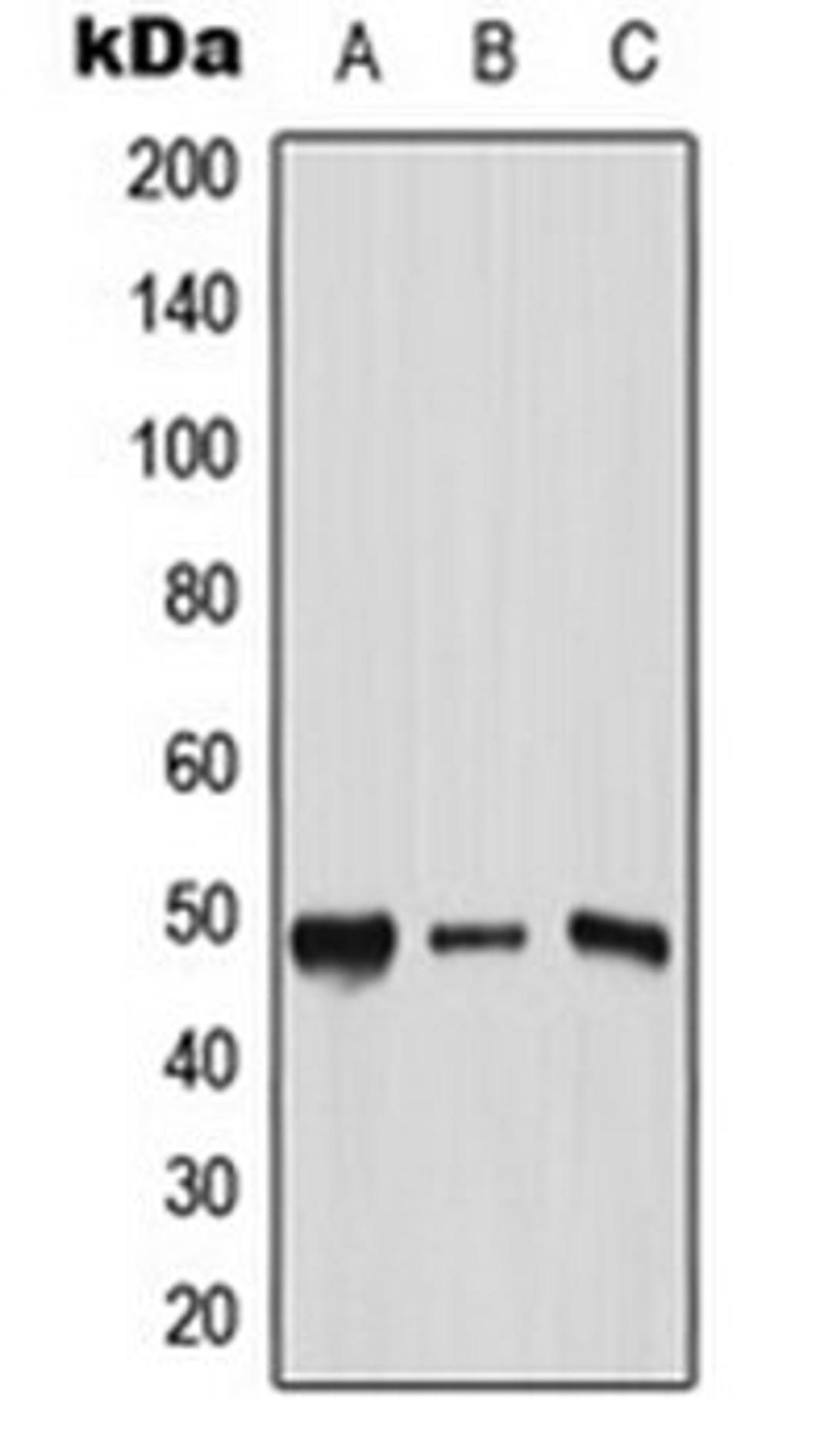 Western blot analysis of HeLa (Lane 1), Raw264.7 (Lane 2), PC12 (Lane 3) whole cell lysates using AP2 gamma antibody