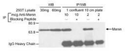 Western Blot: Menin Antibody [NB100-215] - Detection of Human Menin on HeLa whole cell lysate using NB100-215.