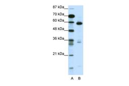 Antibody used in WB on Human Jurkat cells at 1.25 ug/ml.