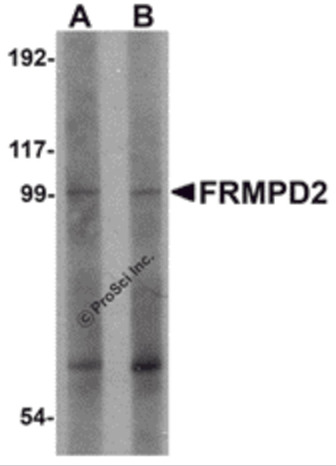 Western blot analysis of FRMPD2 in rat kidney tissue lysate with FRMPD2 antibody at (A) 1 and (B) 2 μg/mL.