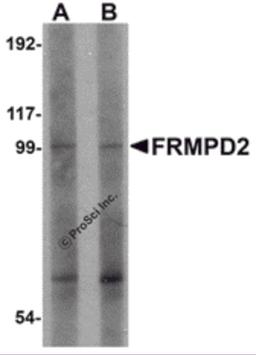 Western blot analysis of FRMPD2 in rat kidney tissue lysate with FRMPD2 antibody at (A) 1 and (B) 2 μg/mL.