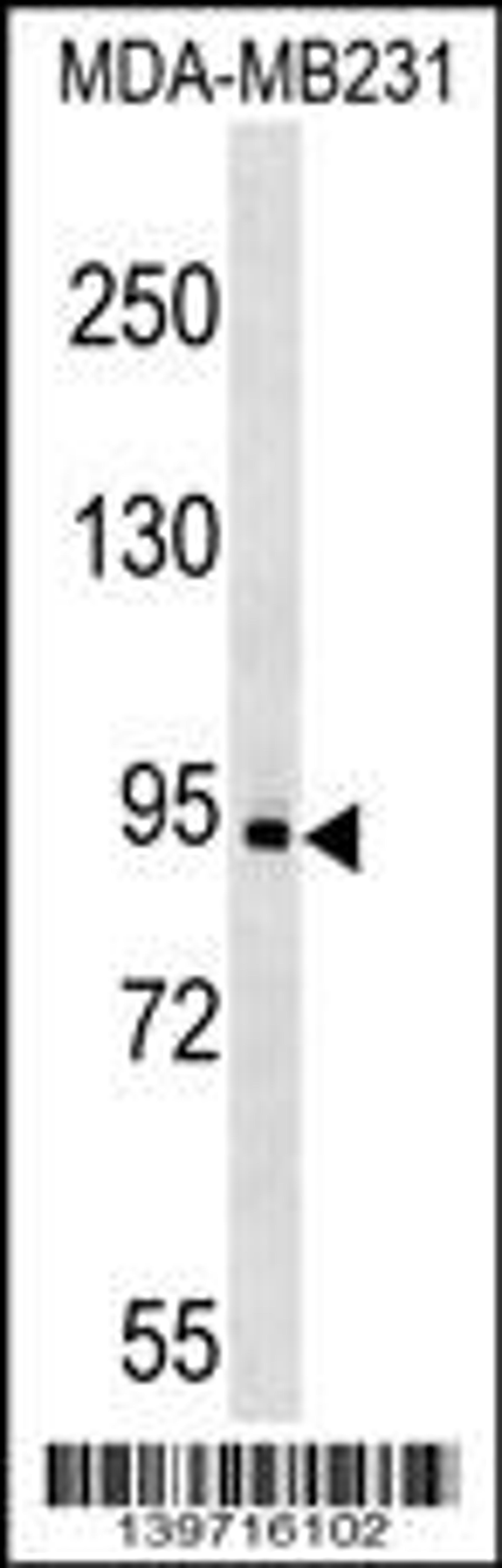 Western blot analysis in MDA-MB231 cell line lysates (35ug/lane).This demonstrates the KIT antibody detected the KIT protein (arrow).