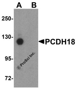 Western blot analysis of PCDH18 in HepG2 cell lysate with PCDH18 antibody at 1 μg/mL in (A) the absence and (B) the presence of blocking peptide.