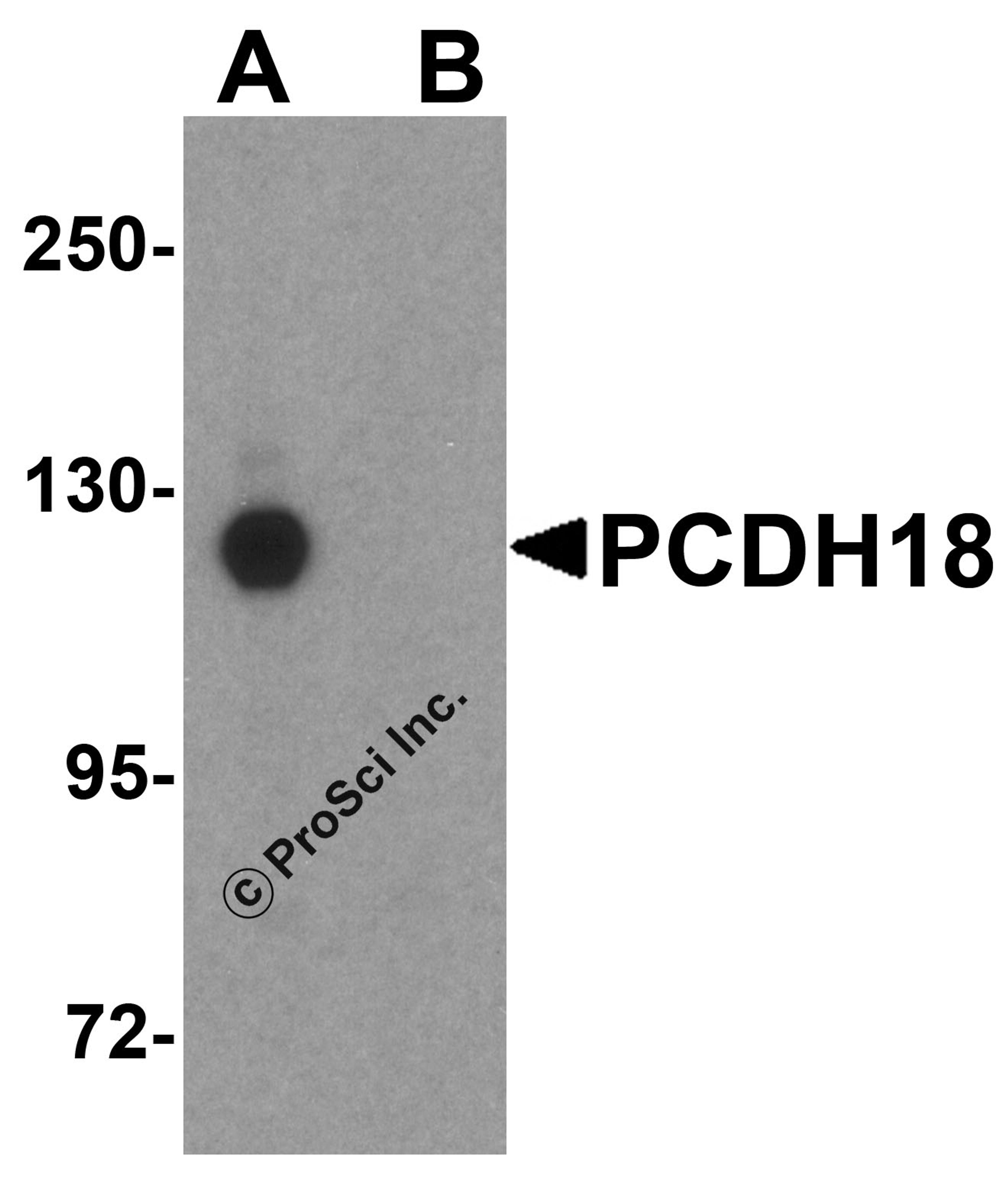 Western blot analysis of PCDH18 in HepG2 cell lysate with PCDH18 antibody at 1 μg/mL in (A) the absence and (B) the presence of blocking peptide.