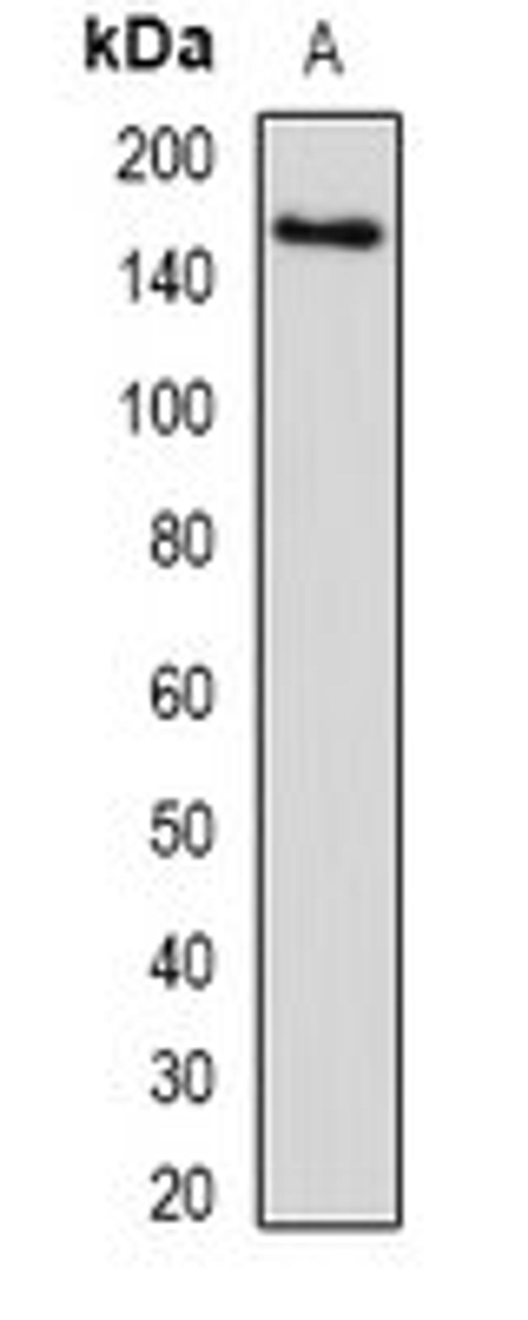 Western blot analysis of human liver (Lane1) whole cell lysates using SETD5 antibody