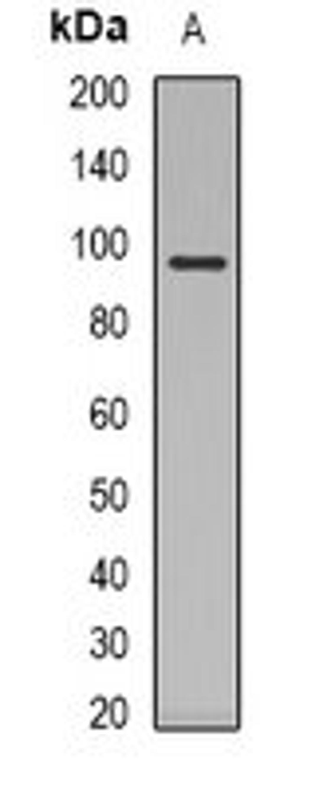 Western blot analysis of Jurkat (Lane 1) whole cell lysates using Glucocorticoid Receptor antibody