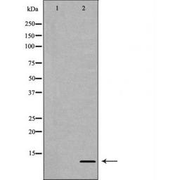 Western blot analysis of HeLa cell line and H3 protein expressed in E.coli using Histone H4R3me2a antibody