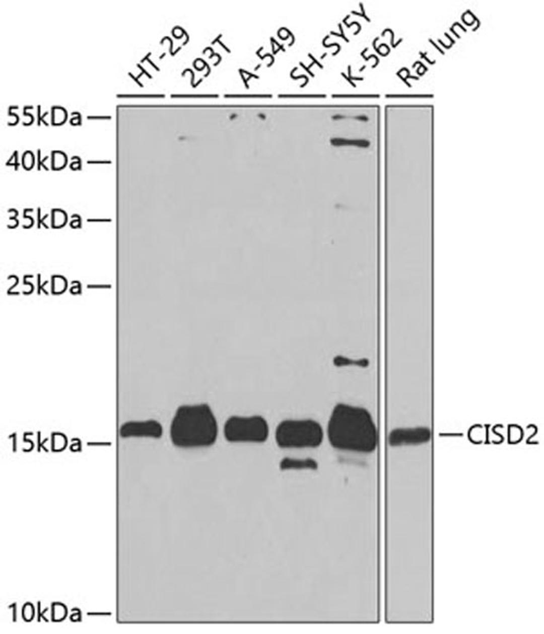 Western blot - CISD2 antibody (A5231)