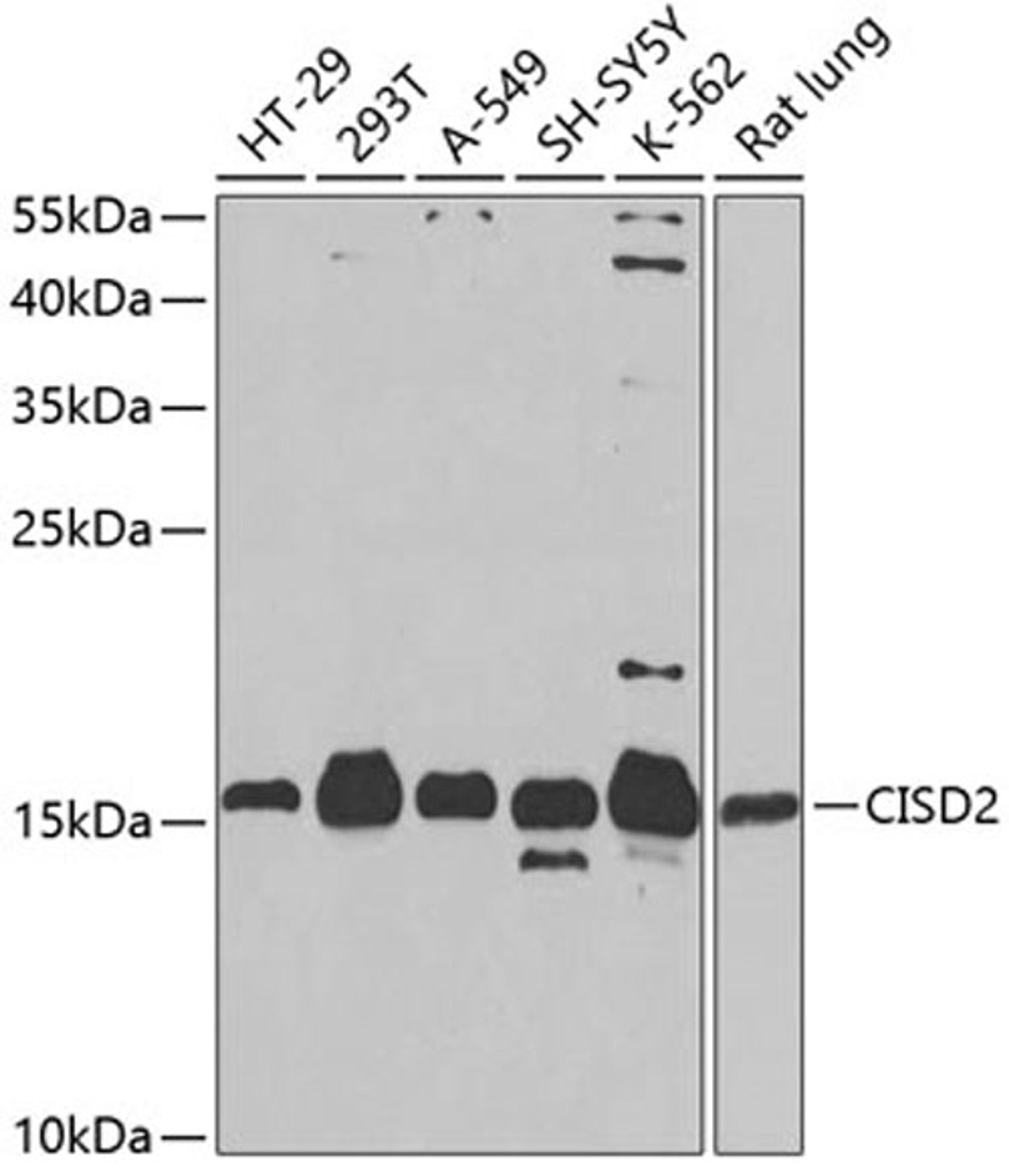 Western blot - CISD2 antibody (A5231)