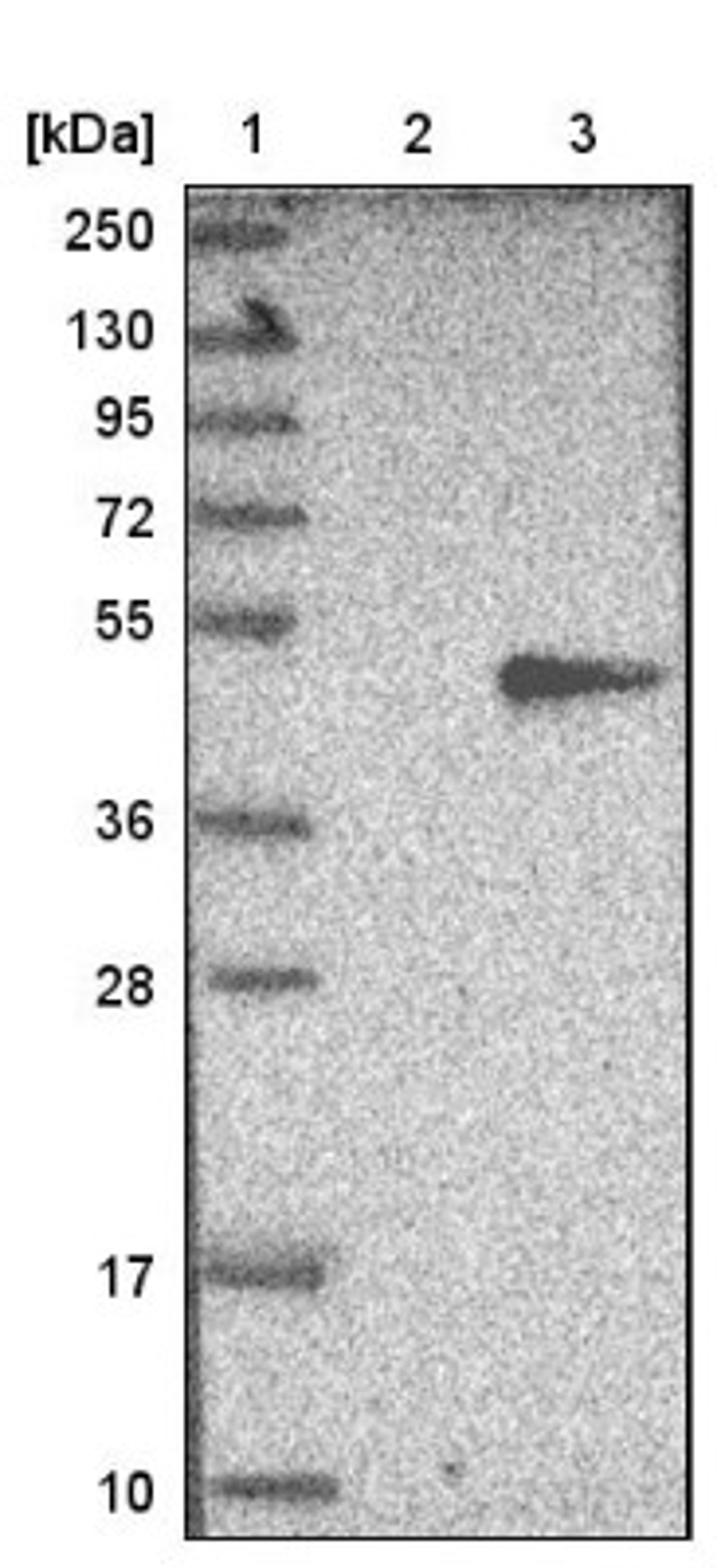 Western Blot: QPCT Antibody [NBP1-81838] - Lane 1: Marker [kDa] 250, 130, 95, 72, 55, 36, 28, 17, 10<br/>Lane 2: Negative control (vector only transfected HEK293T lysate)<br/>Lane 3: Over-expression lysate (Co-expressed with a C-terminal myc-DDK tag (~3.1 kDa) in mammalian HEK293T cells, LY415772)