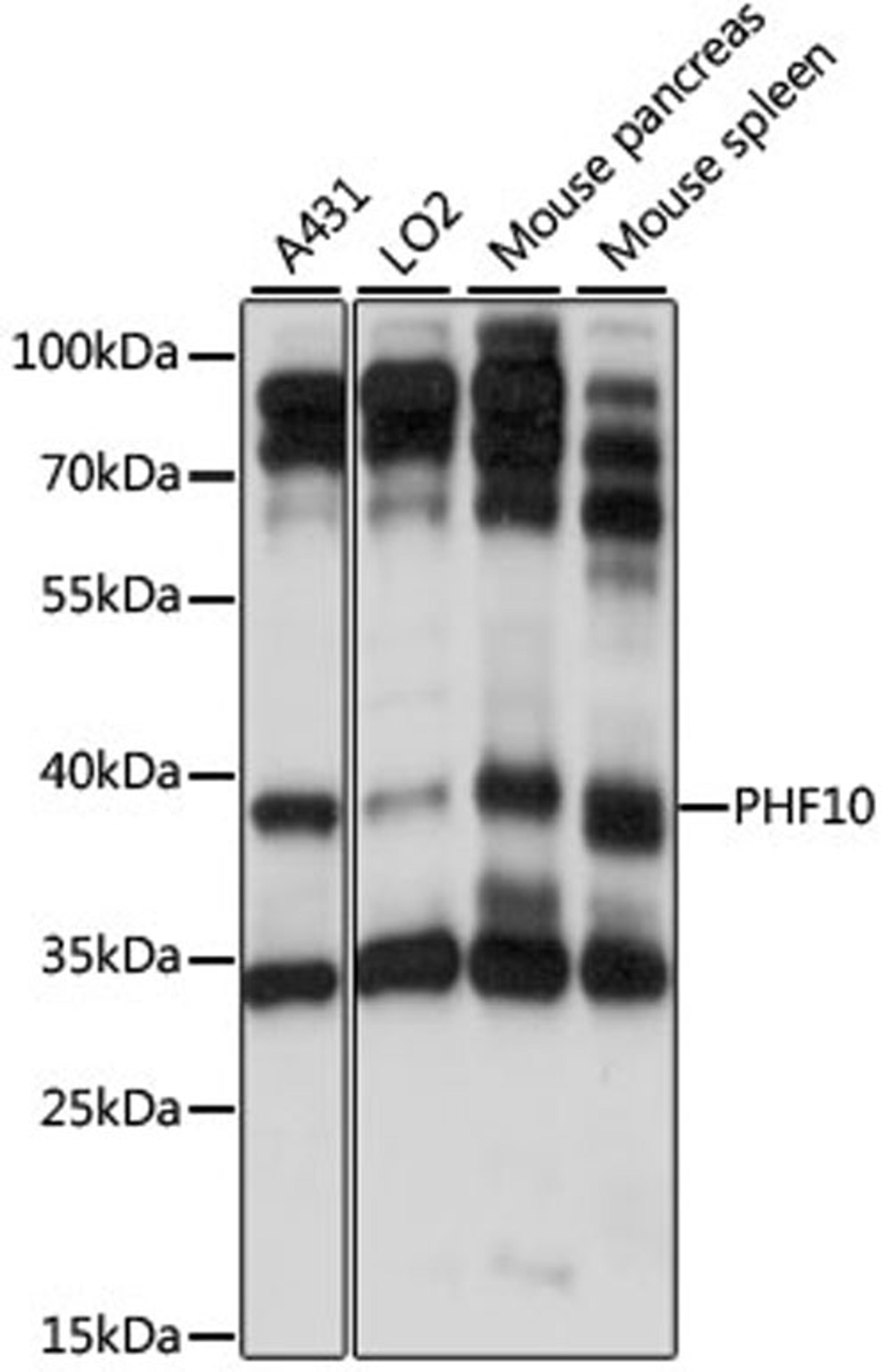 Western blot - PHF10 antibody (A15466)