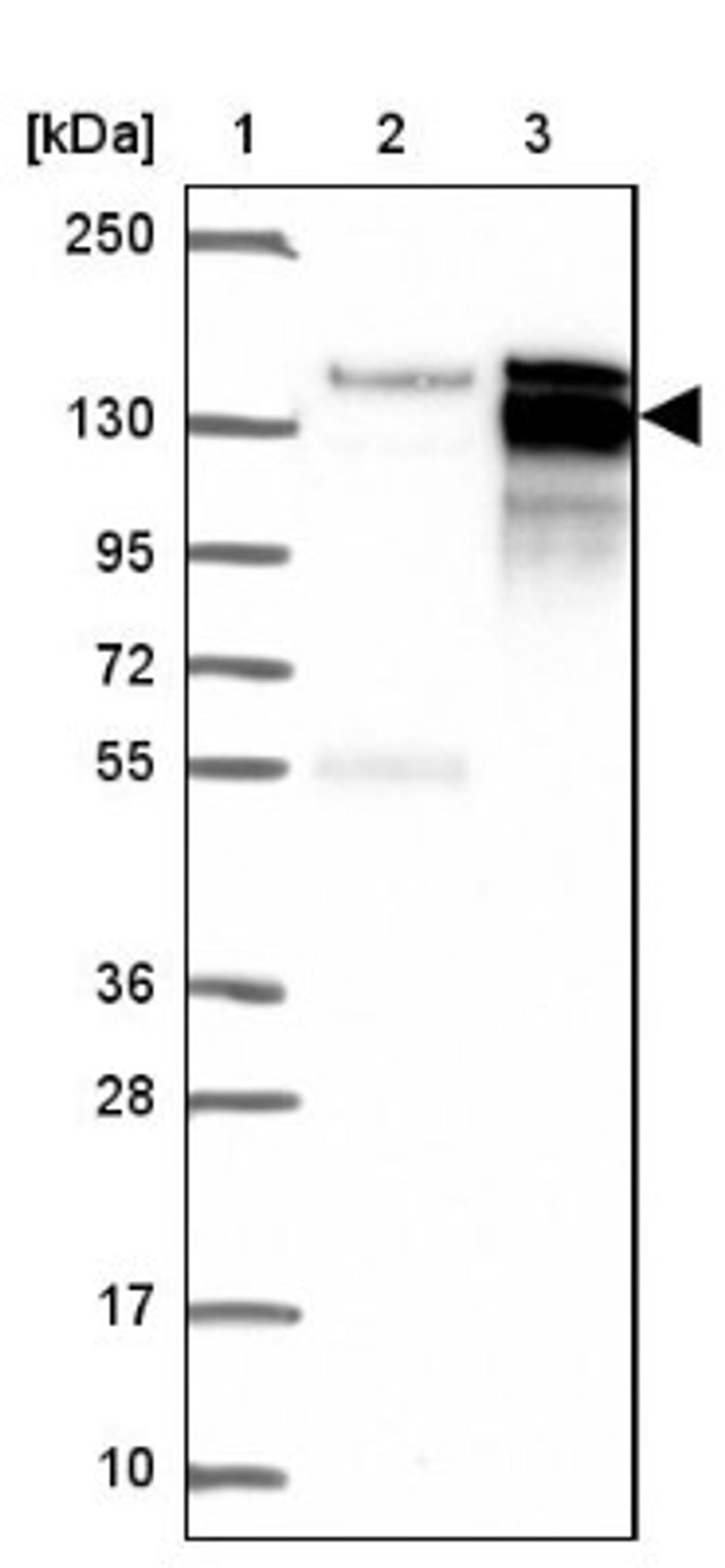 Western Blot: AFTPH Antibody [NBP2-38227] - Lane 1: Marker [kDa] 250, 130, 95, 72, 55, 36, 28, 17, 10<br/>Lane 2: Negative Control<br/>Lane 3: LY413655