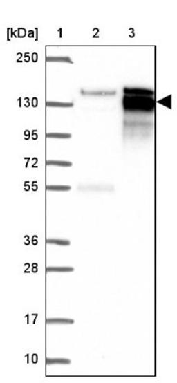 Western Blot: AFTPH Antibody [NBP2-38227] - Lane 1: Marker [kDa] 250, 130, 95, 72, 55, 36, 28, 17, 10<br/>Lane 2: Negative Control<br/>Lane 3: LY413655