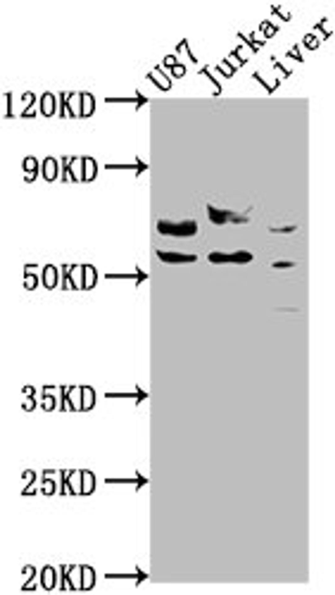 Western Blot. Positive WB detected in: U87 whole cell lysate, Jurkat whole cell lysate, Rat liver tissue. All lanes: CDK5RAP3 antibody at 1:1000. Secondary. Goat polyclonal to rabbit IgG at 1/50000 dilution. Predicted band size: 57, 47, 32, 60 kDa. Observed band size: 57 kDa. 