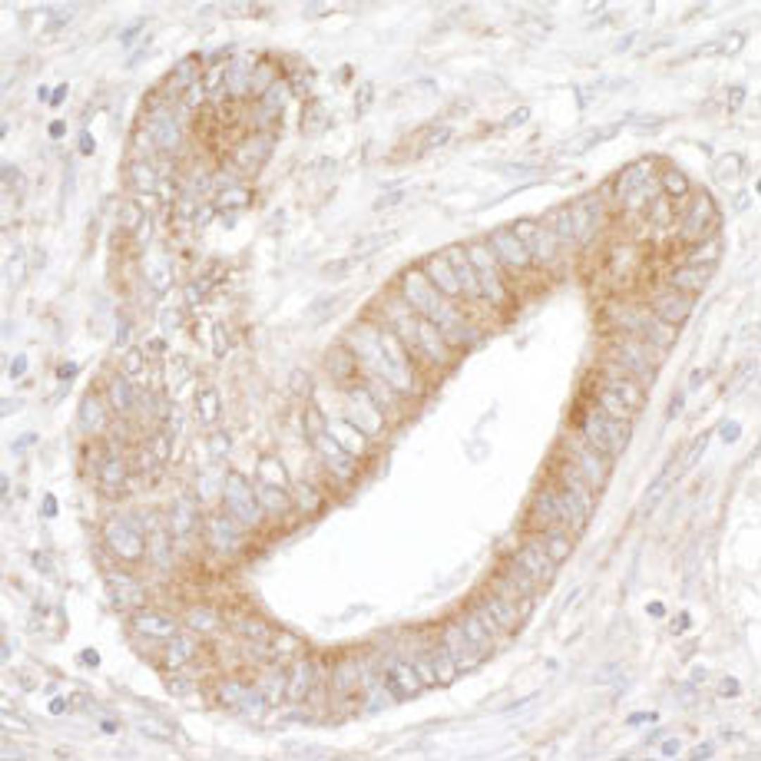 Detection of human IP3R3 by immunohistochemistry.