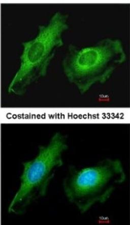 Immunocytochemistry/Immunofluorescence: ITM2B Antibody [NBP2-17000] - Analysis of methanol-fixed HeLa, using antibody at 1:200 dilution.