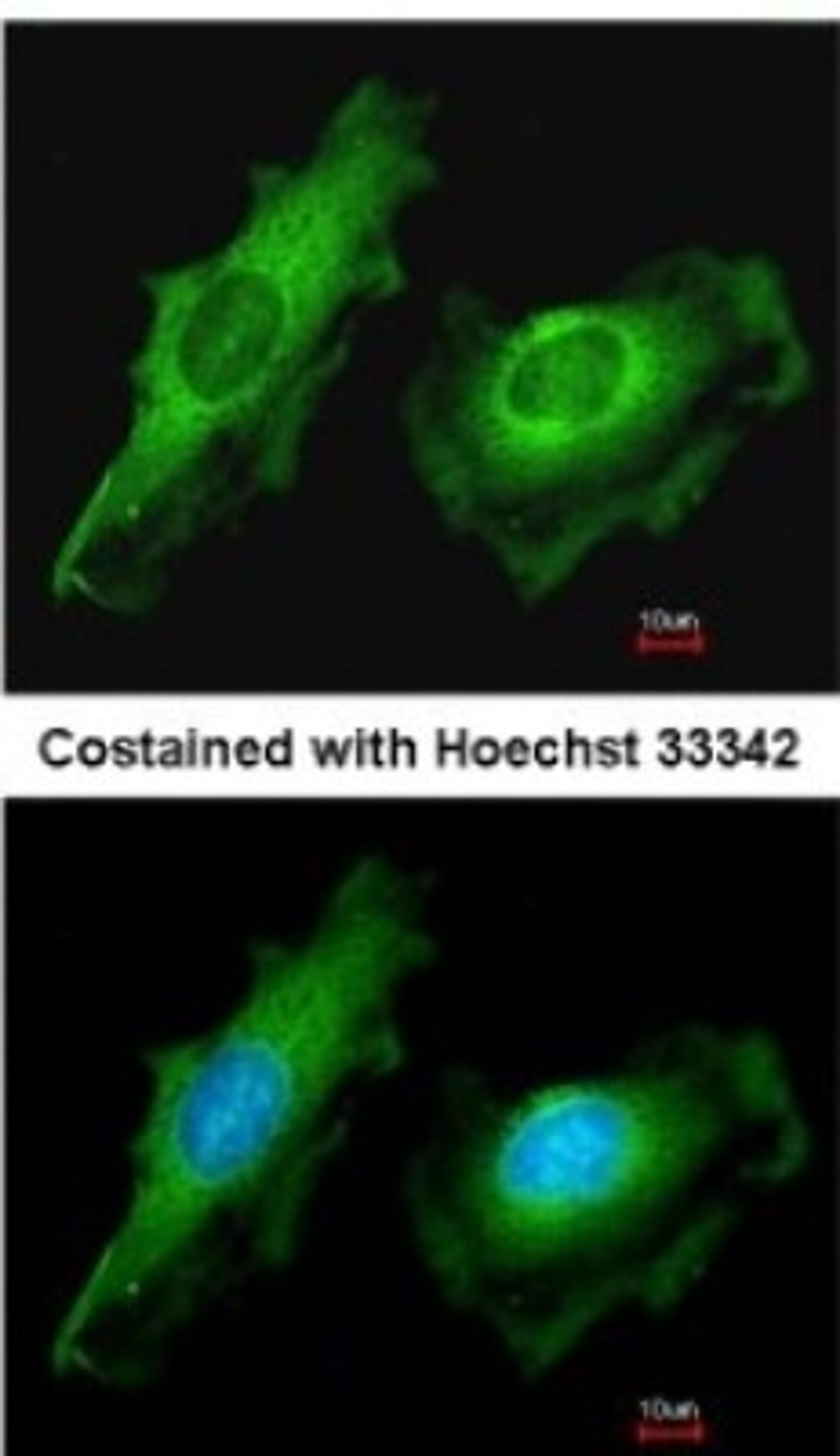 Immunocytochemistry/Immunofluorescence: ITM2B Antibody [NBP2-17000] - Analysis of methanol-fixed HeLa, using antibody at 1:200 dilution.