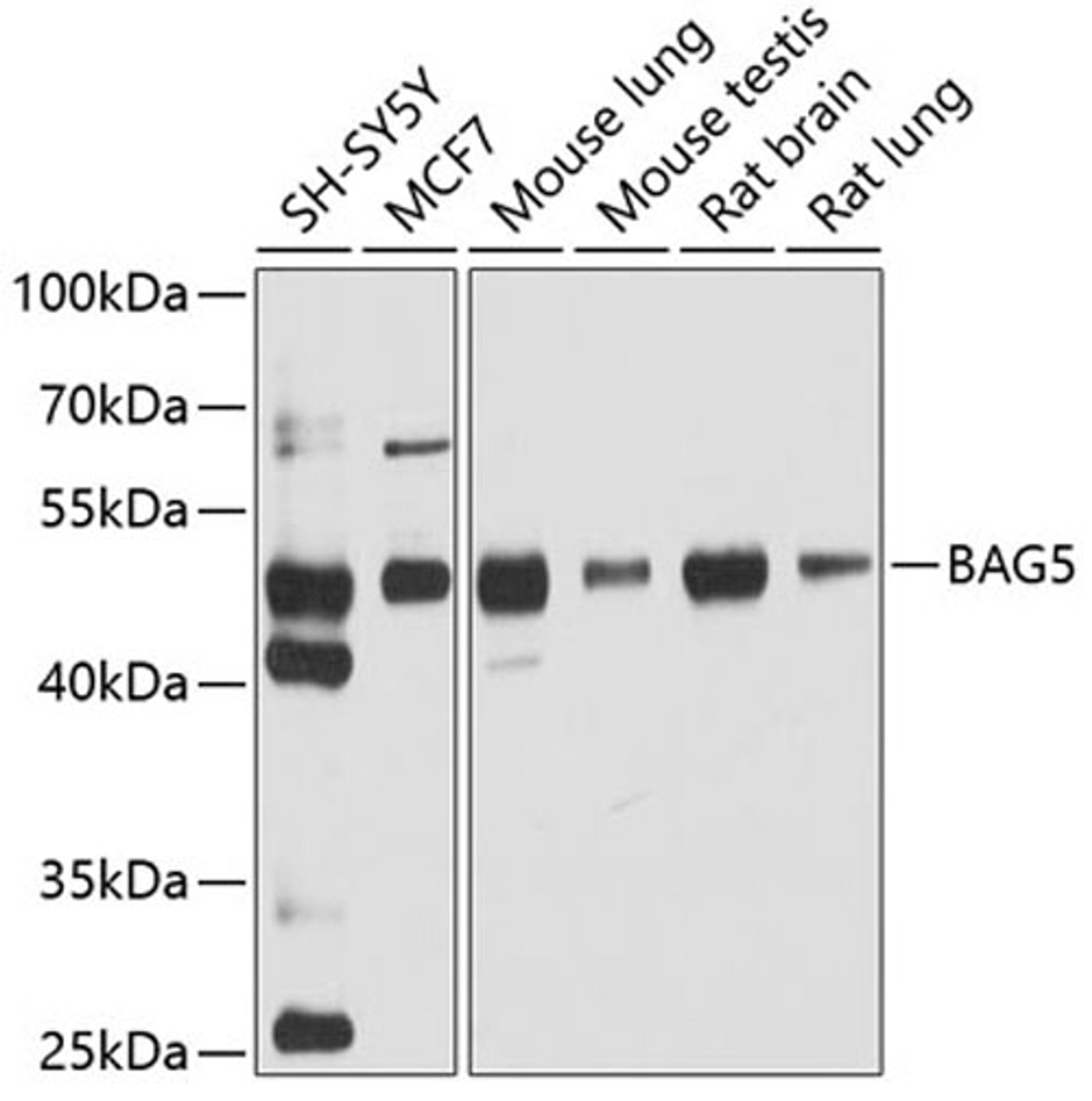 Western blot - BAG5 antibody (A5794)