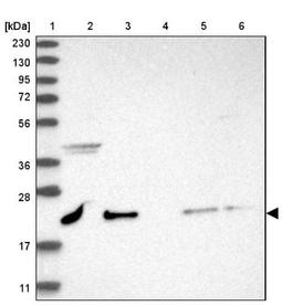 Western Blot: NRIF3 Antibody [NBP1-85687] - Lane 1: Marker [kDa] 230, 130, 95, 72, 56, 36, 28, 17, 11<br/>Lane 2: Human cell line RT-4<br/>Lane 3: Human cell line U-251MG sp<br/>Lane 4: Human plasma (IgG/HSA depleted)<br/>Lane 5: Human liver tissue<br/>Lane 6: Human tonsil tissue