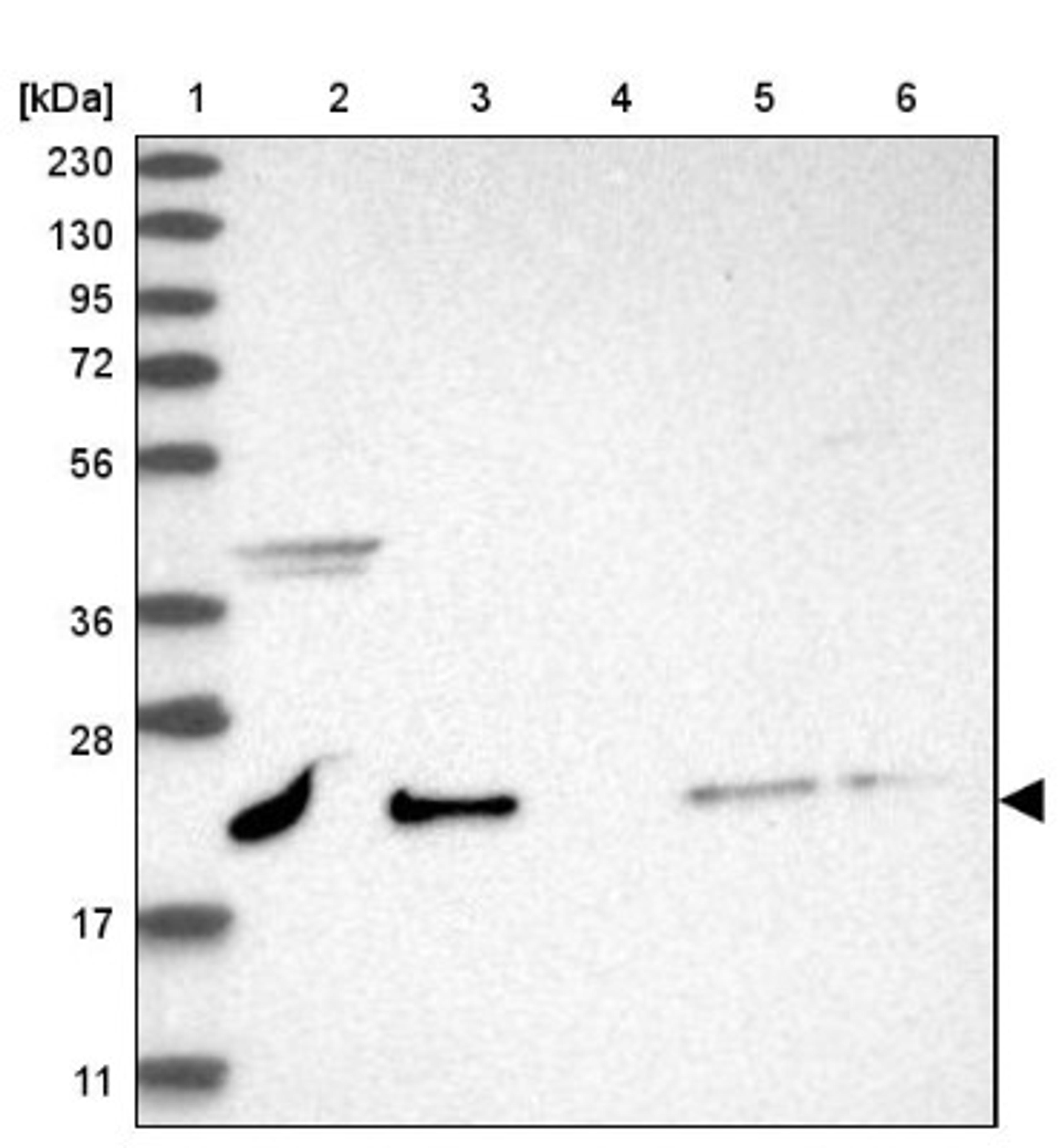 Western Blot: NRIF3 Antibody [NBP1-85687] - Lane 1: Marker [kDa] 230, 130, 95, 72, 56, 36, 28, 17, 11<br/>Lane 2: Human cell line RT-4<br/>Lane 3: Human cell line U-251MG sp<br/>Lane 4: Human plasma (IgG/HSA depleted)<br/>Lane 5: Human liver tissue<br/>Lane 6: Human tonsil tissue