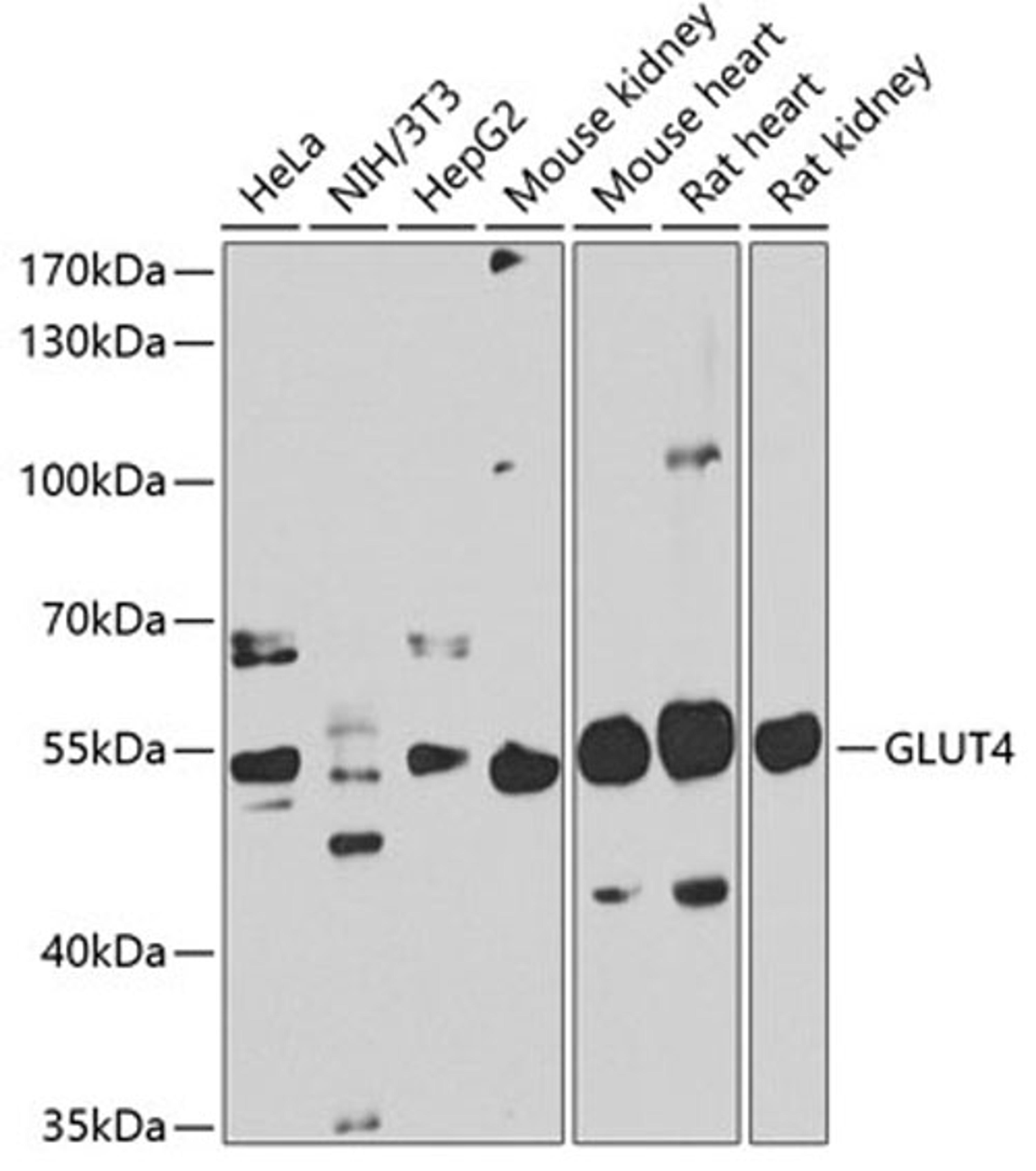 Western blot - GLUT4 antibody (A7637)