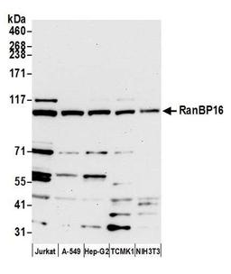 Detection of human and mouse RanBP16 by WB.