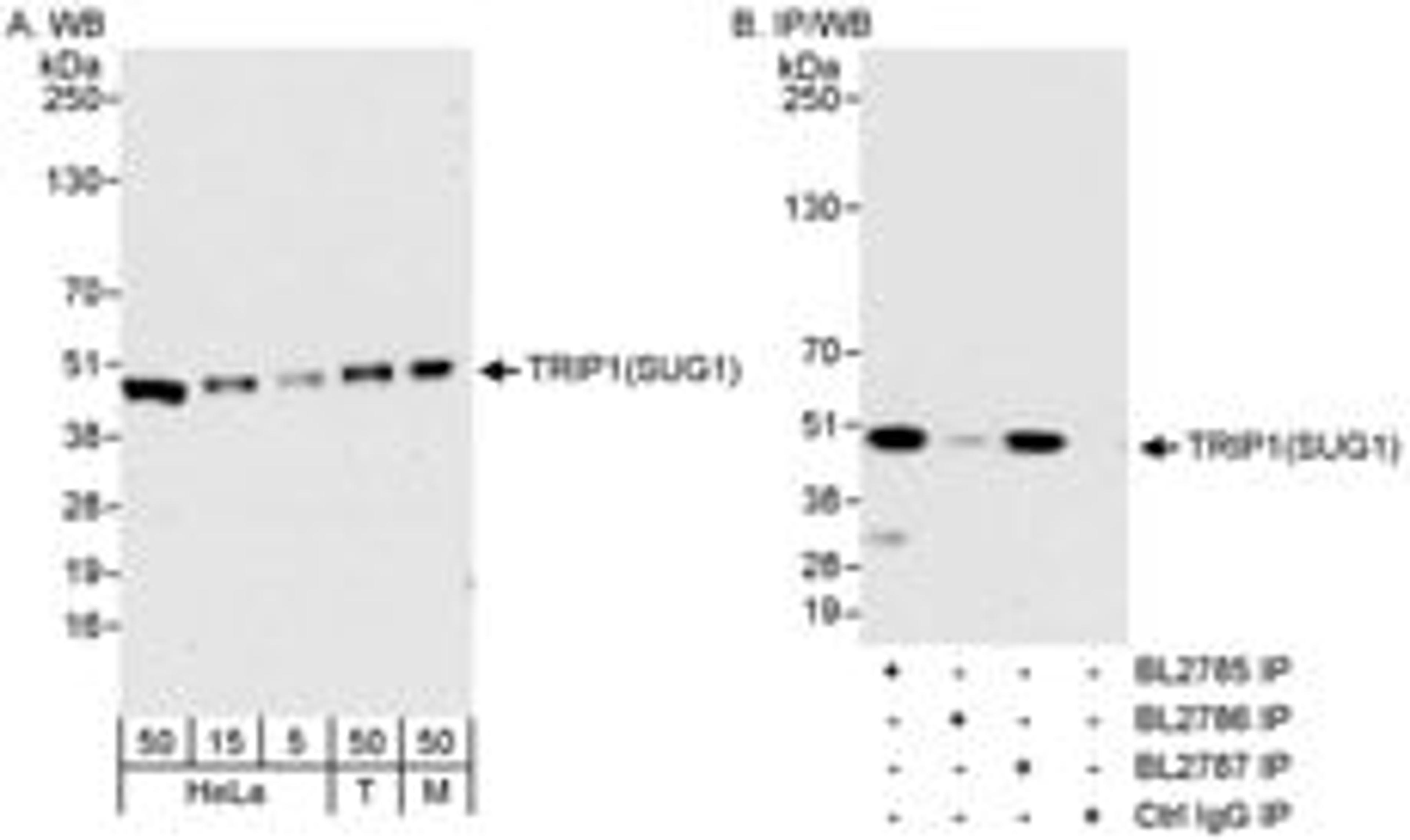 Detection of human and mouse TRIP1(SUG1) by western blot (h&m) and immunoprecipitation (h).