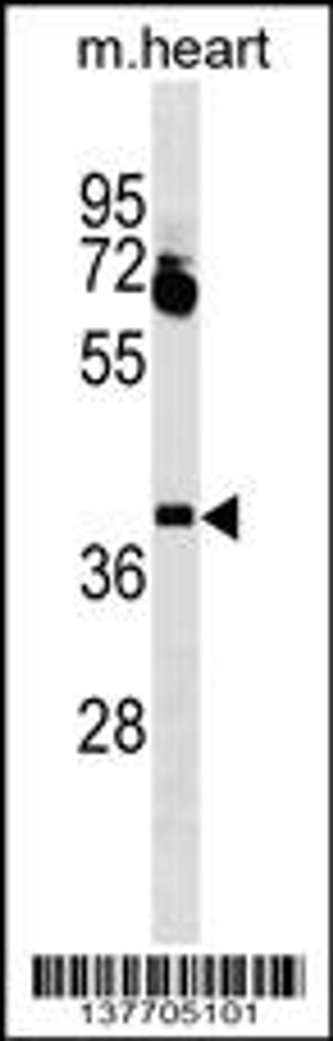 Western blot analysis in mouse heart tissue lysates (35ug/lane).