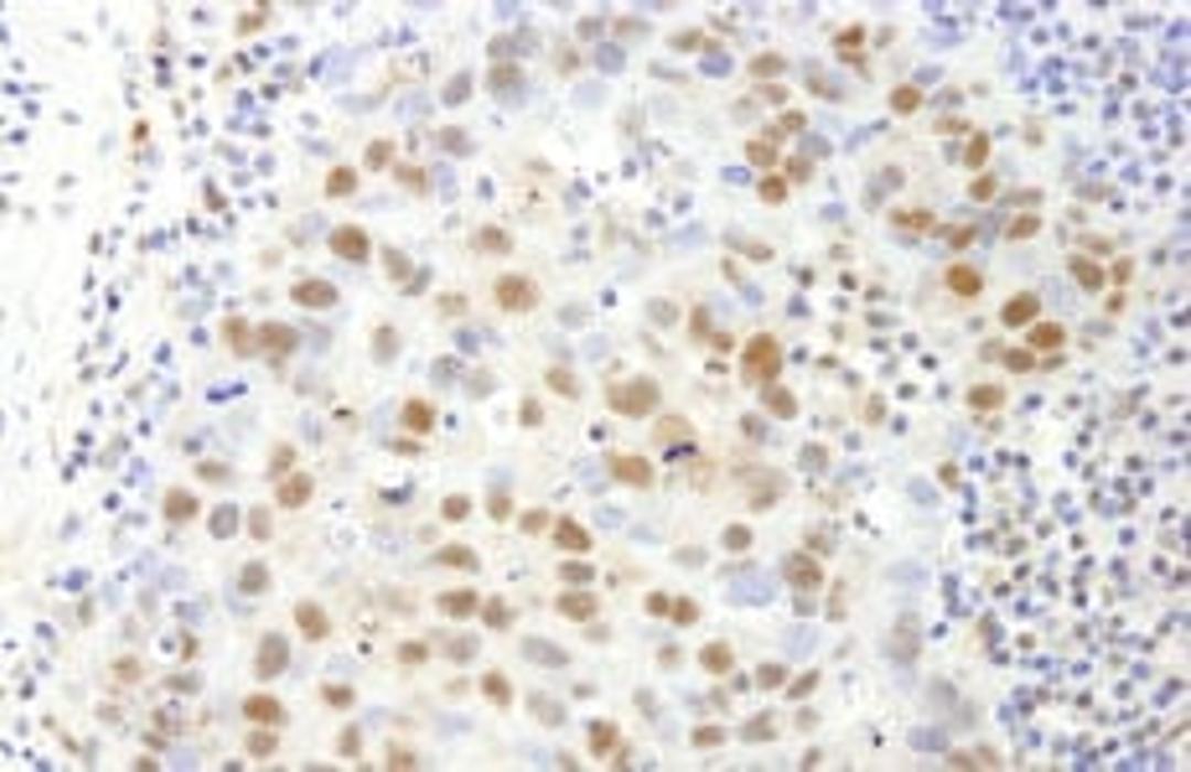 Detection of human SAFB1 by immunohistochemistry.