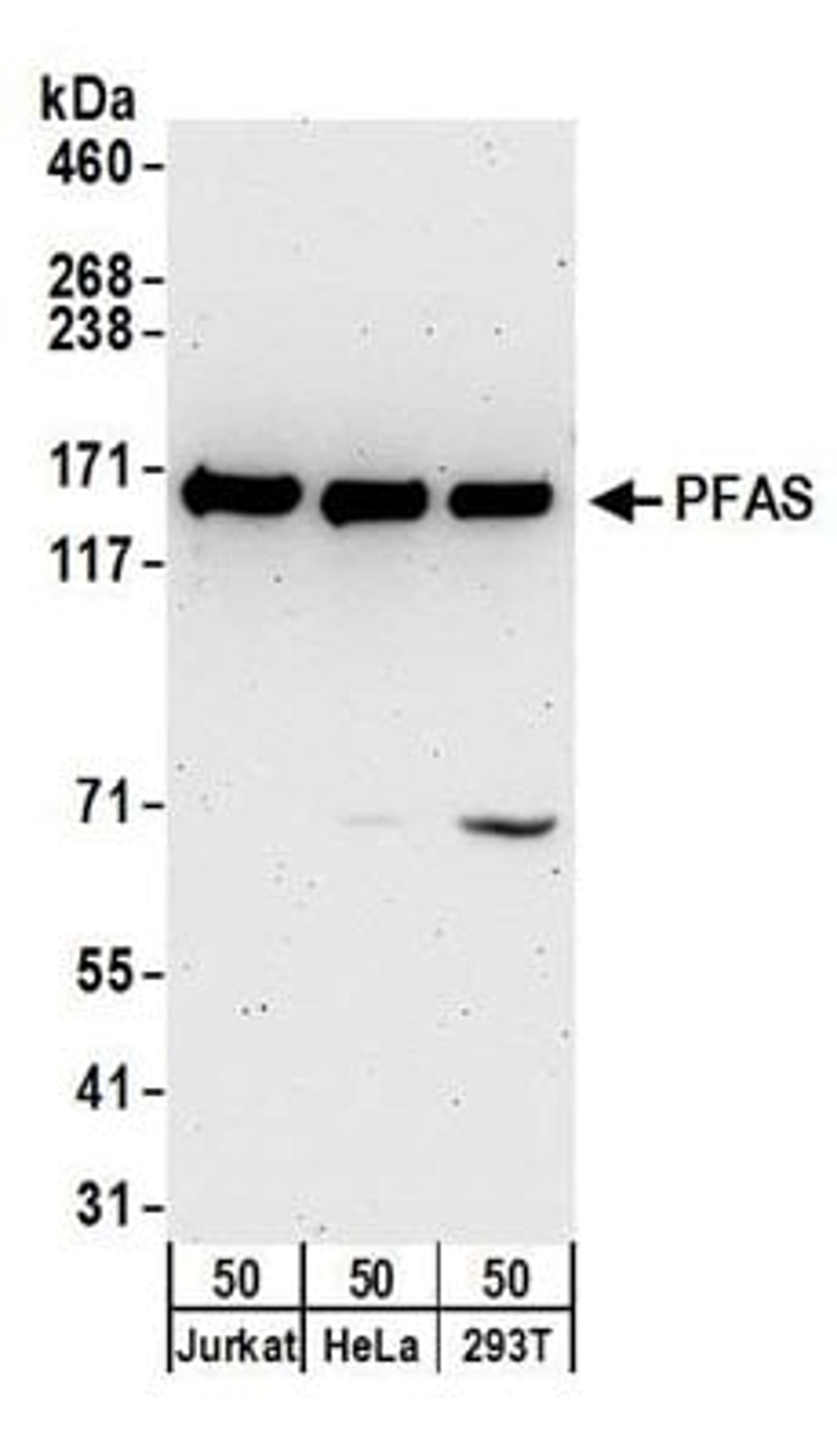 Detection of human PFAS by western blot.