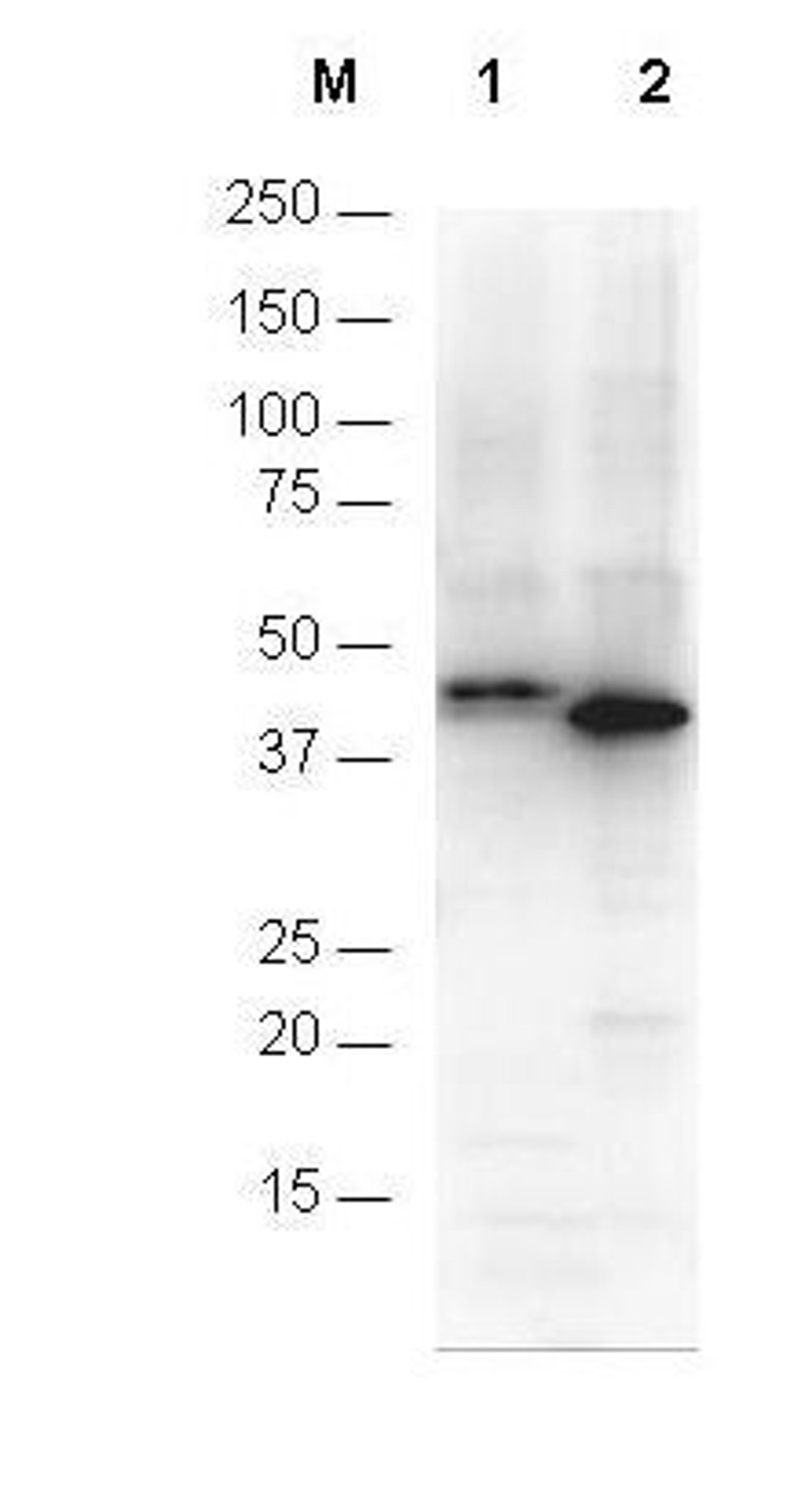 Western blot analysis of His-tagged recombinant proteins using 6X HIS EPITOPE TAG antibody