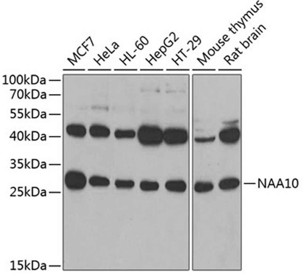 Western blot - NAA10 antibody (A7009)