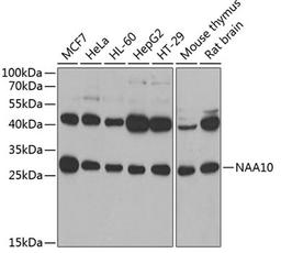 Western blot - NAA10 antibody (A7009)