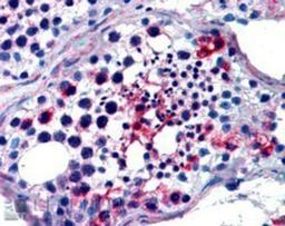 Immunohistochemistry: FHL1 Antibody [NB100-1460] - (2.5ug/ml) staining of paraffin embedded Human Testis. Steamed antigen retrieval with citrate buffer pH 6, AP-staining.