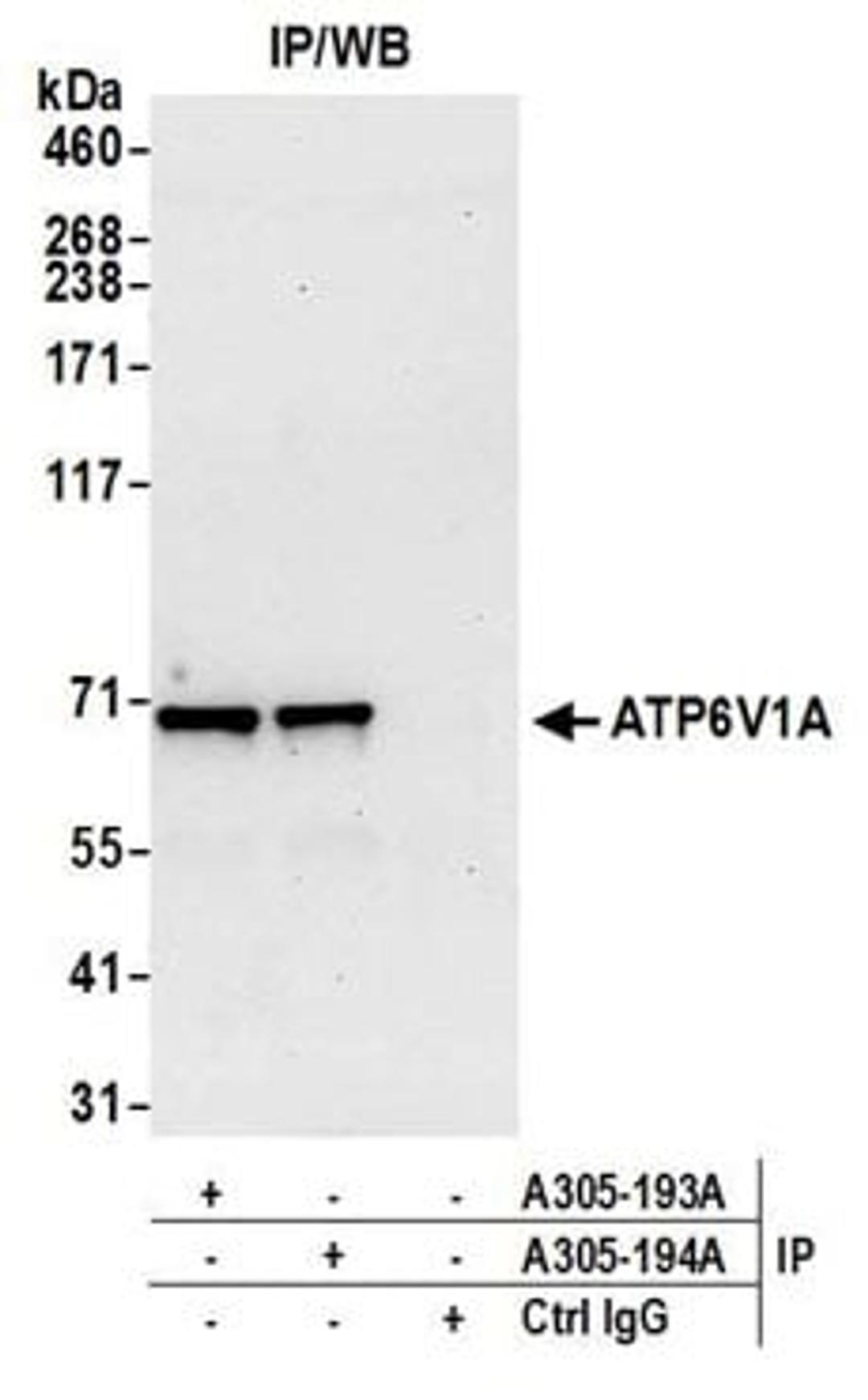 Detection of human ATP6V1A by western blot of immunoprecipitates.