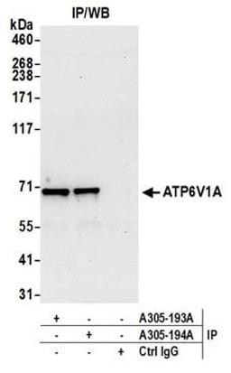 Detection of human ATP6V1A by western blot of immunoprecipitates.