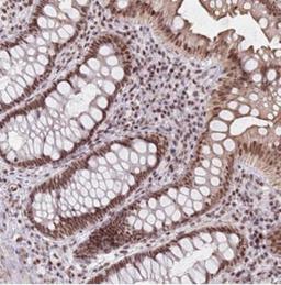 Immunohistochemistry: TNFAIP8L3 Antibody [NBP2-33522] - Immunohistochemical staining of human rectum shows moderate nuclear positivity in glandular cells.