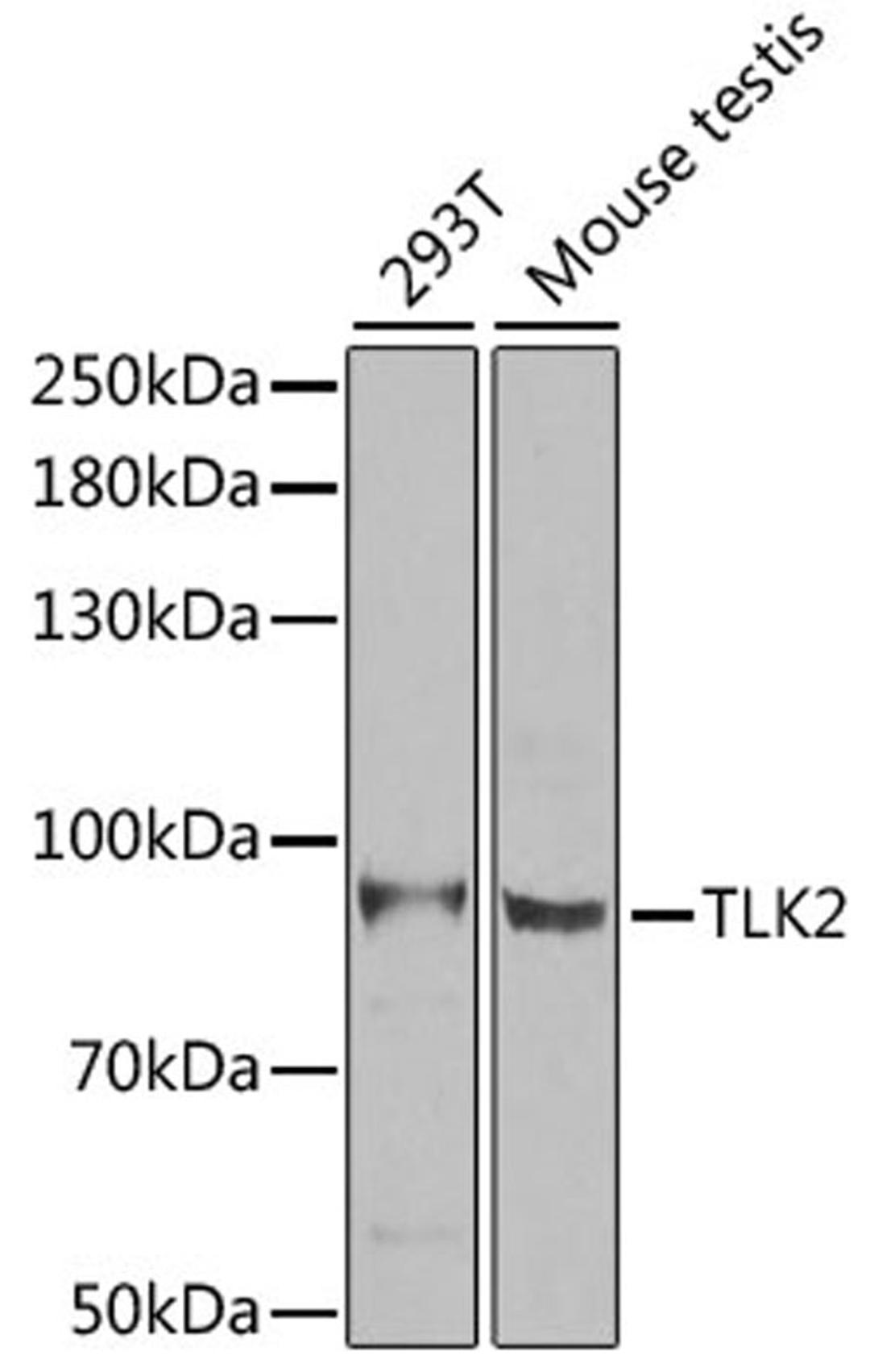 Western blot - TLK2 antibody (A6770)