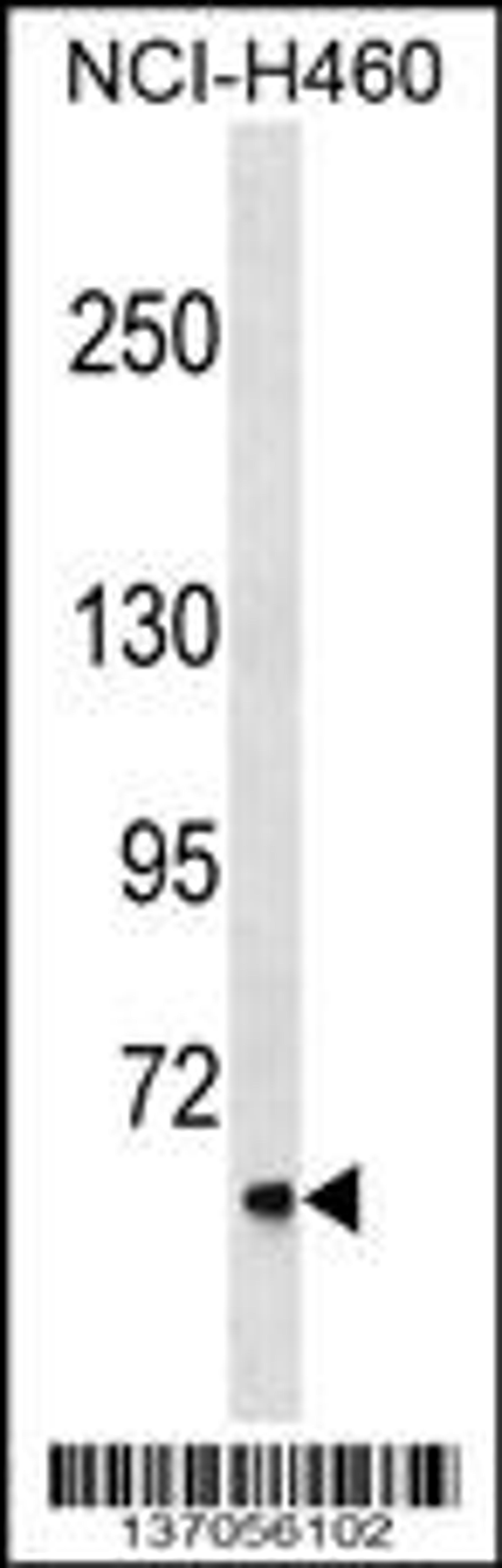 Western blot analysis in NCI-H460 cell line lysates (35ug/lane).