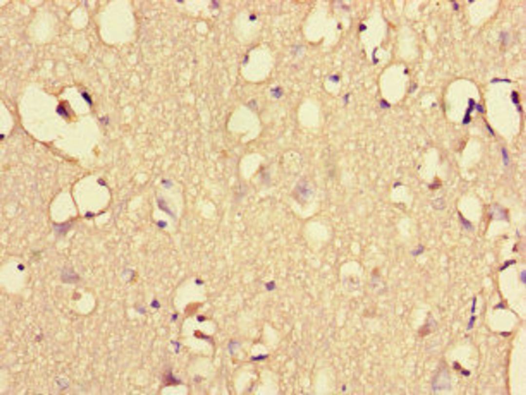 Immunohistochemistry of paraffin-embedded human brain tissue using CSB-PA878940LA01HU at dilution of 1:100