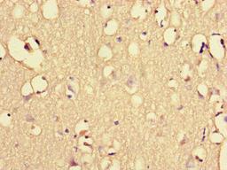 Immunohistochemistry of paraffin-embedded human brain tissue using CSB-PA878940LA01HU at dilution of 1:100