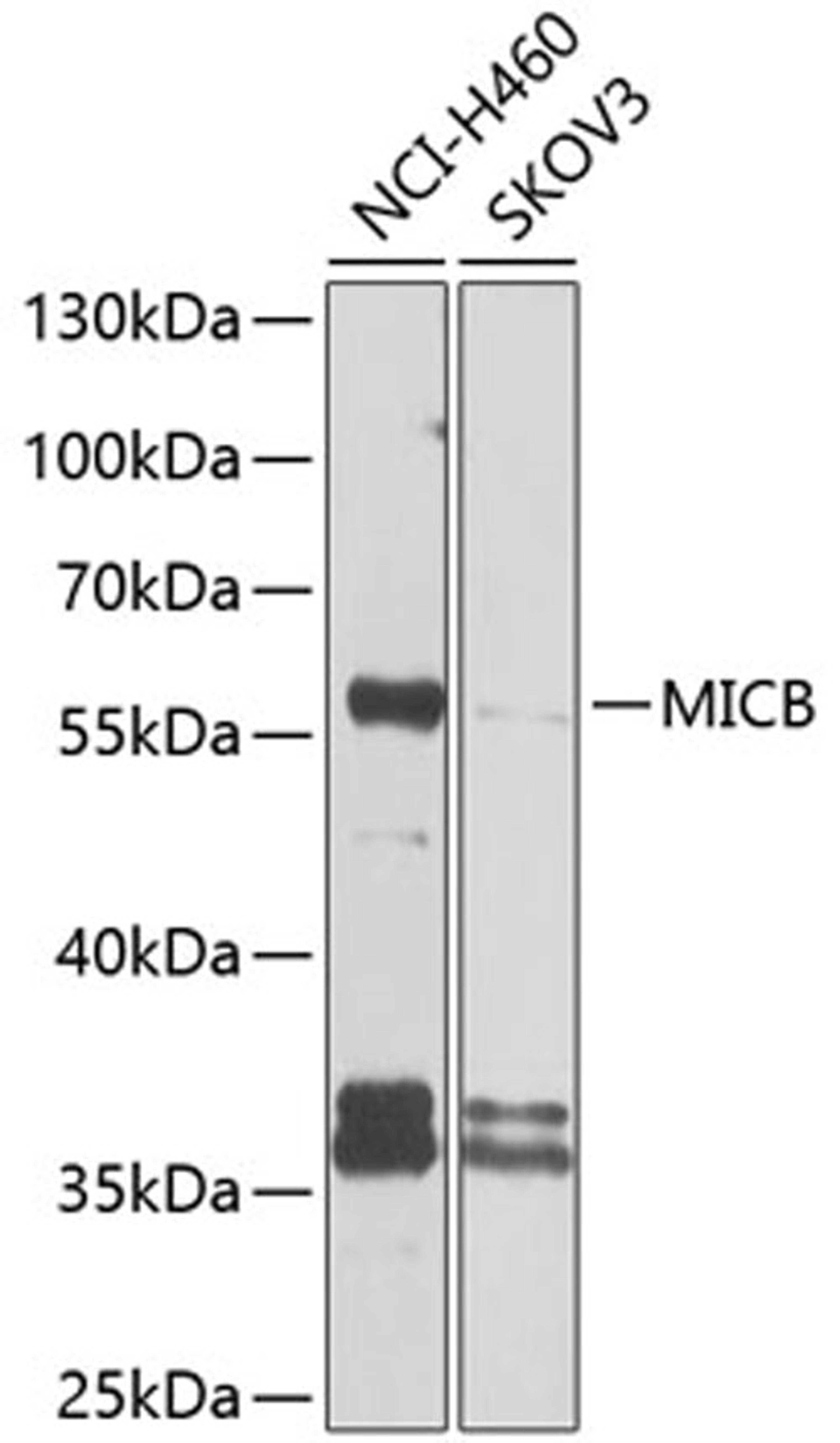 Western blot - MICB antibody (A9802)